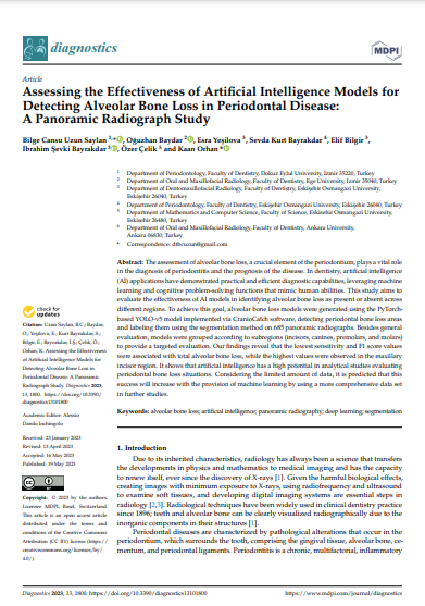 Assessing the Effectiveness of Artificial Intelligence Models for Detecting Alveolar Bone Loss in Periodontal Disease