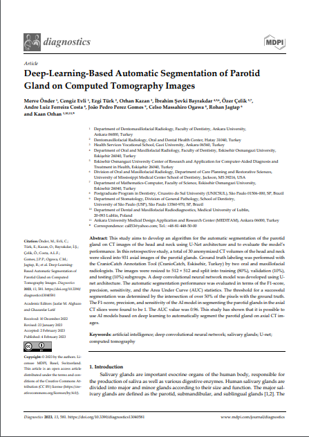 Deep-Learning-Based Automatic Segmentation of Parotid Gland on Computed Tomography Images