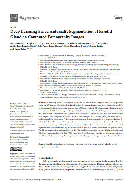Bilgisayarlı Tomografi Görüntülerinde Parotis Bezinin Derin Öğrenme Tabanlı Otomatik Segmentasyonu