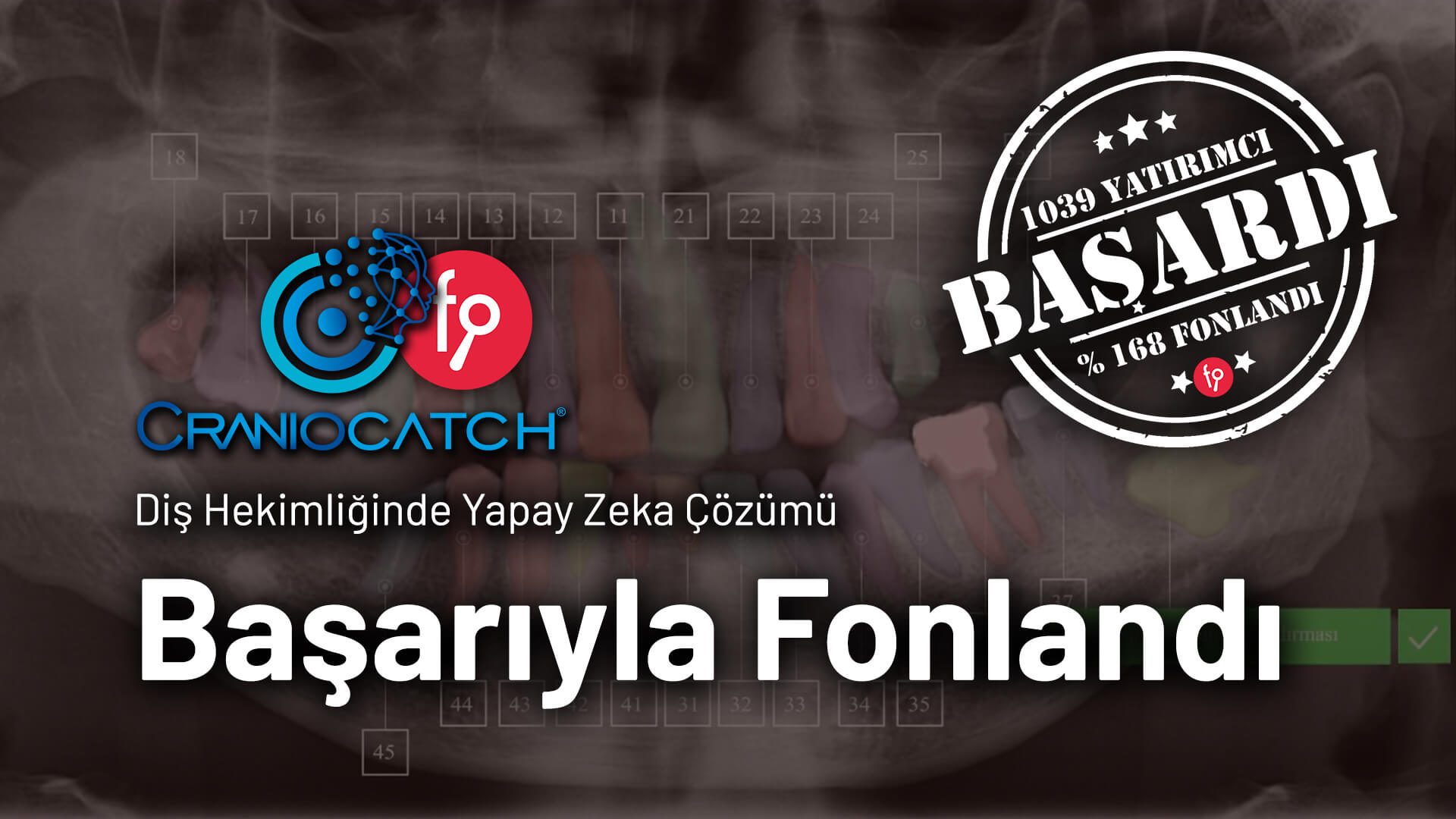 CranioCatch 12 saatlik yatırım turu başarıyla sonuçlandı  CranioCatch news and blog page-Investment tour result