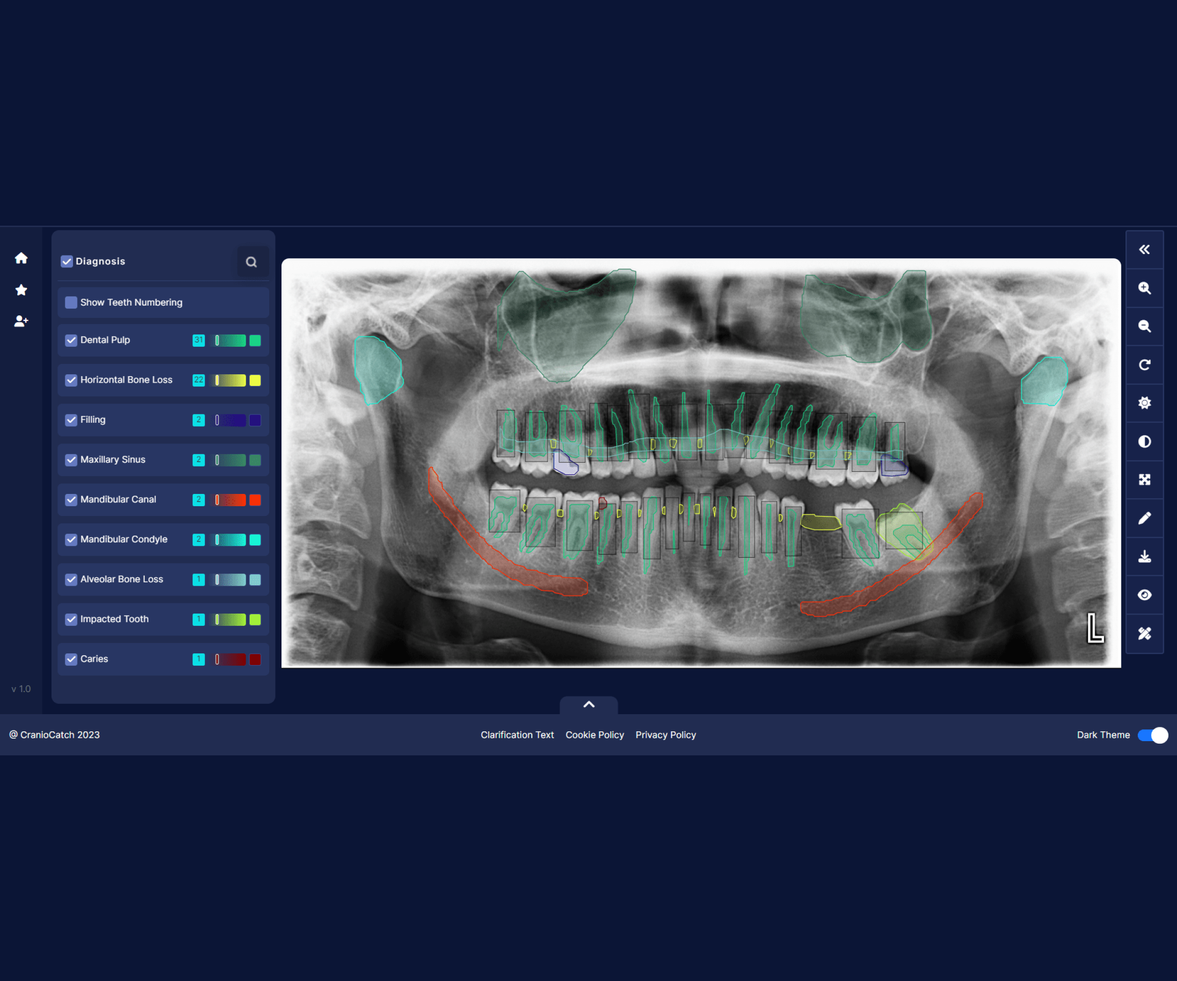 CranioCatch haber ve blog sayfası - CranioCatch, dental turizme ivme kazandıracak!