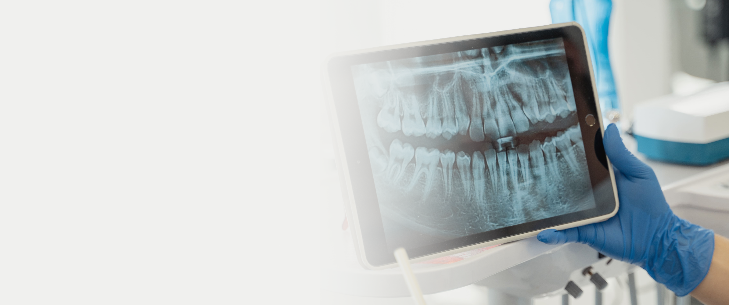 Yapay Zeka Destekli Dental Uygulamanın Benimsenmesi: Diş Sağlığında Bir Devrim