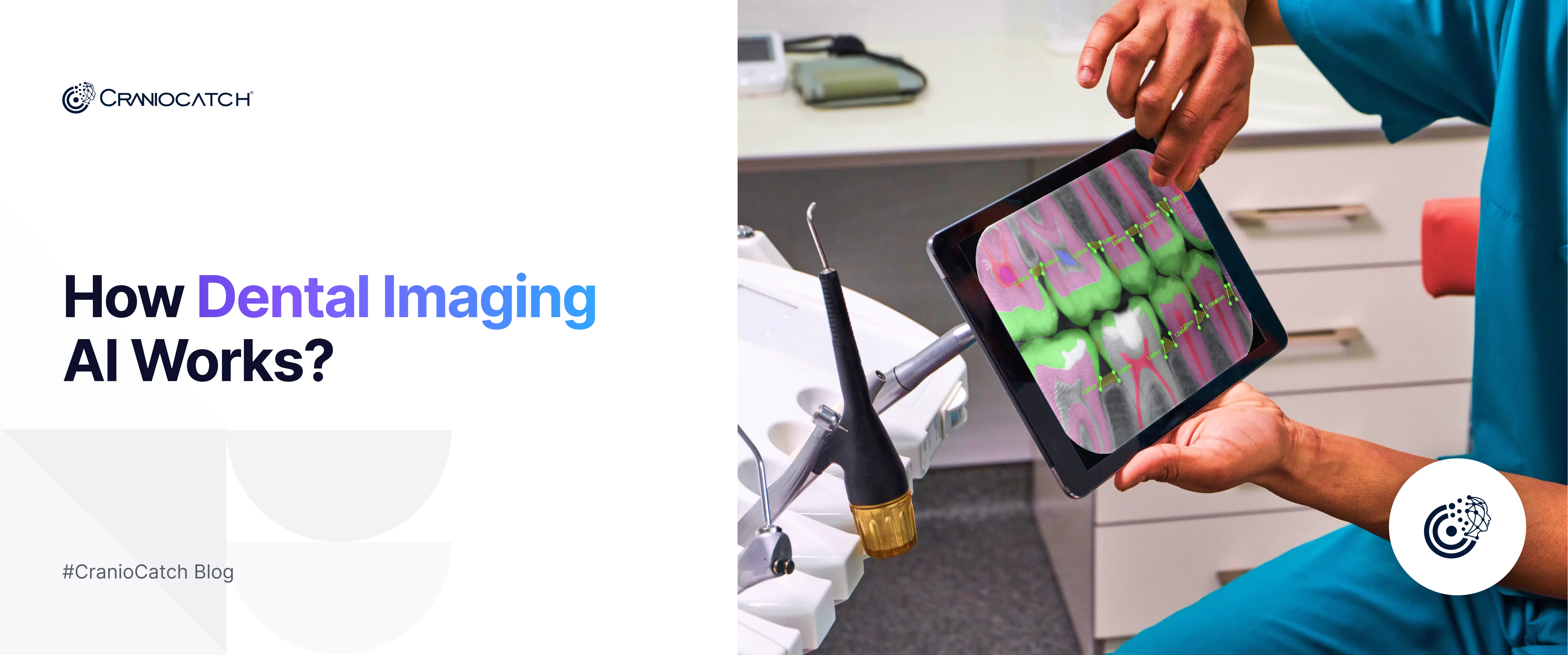 Diş Yapay Zekası Nasıl Çalışır? Röntgen Analiz Rehberi