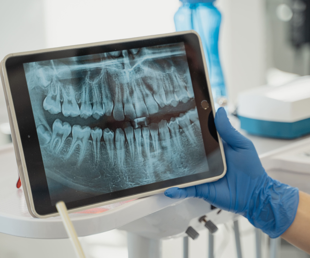 Yapay Zeka Destekli Dental Uygulamanın Benimsenmesi: Diş Sağlığında Bir Devrim