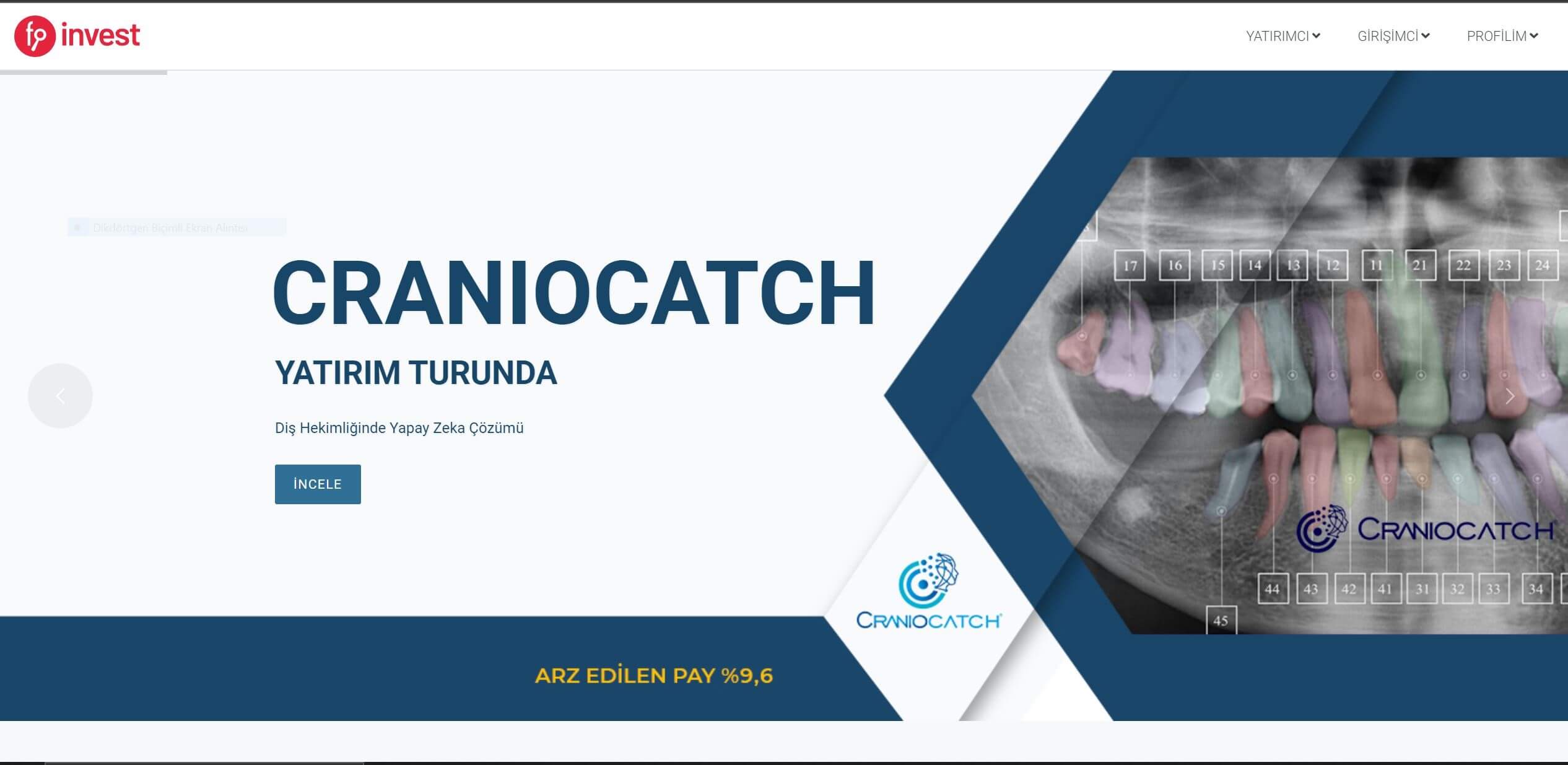 CranioCatch news and blog page- Fonbulucu