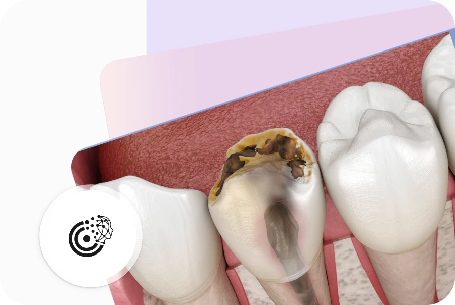 Diş Enfeksiyonu Nedir ve Neden Ciddiye Alınmalıdır?