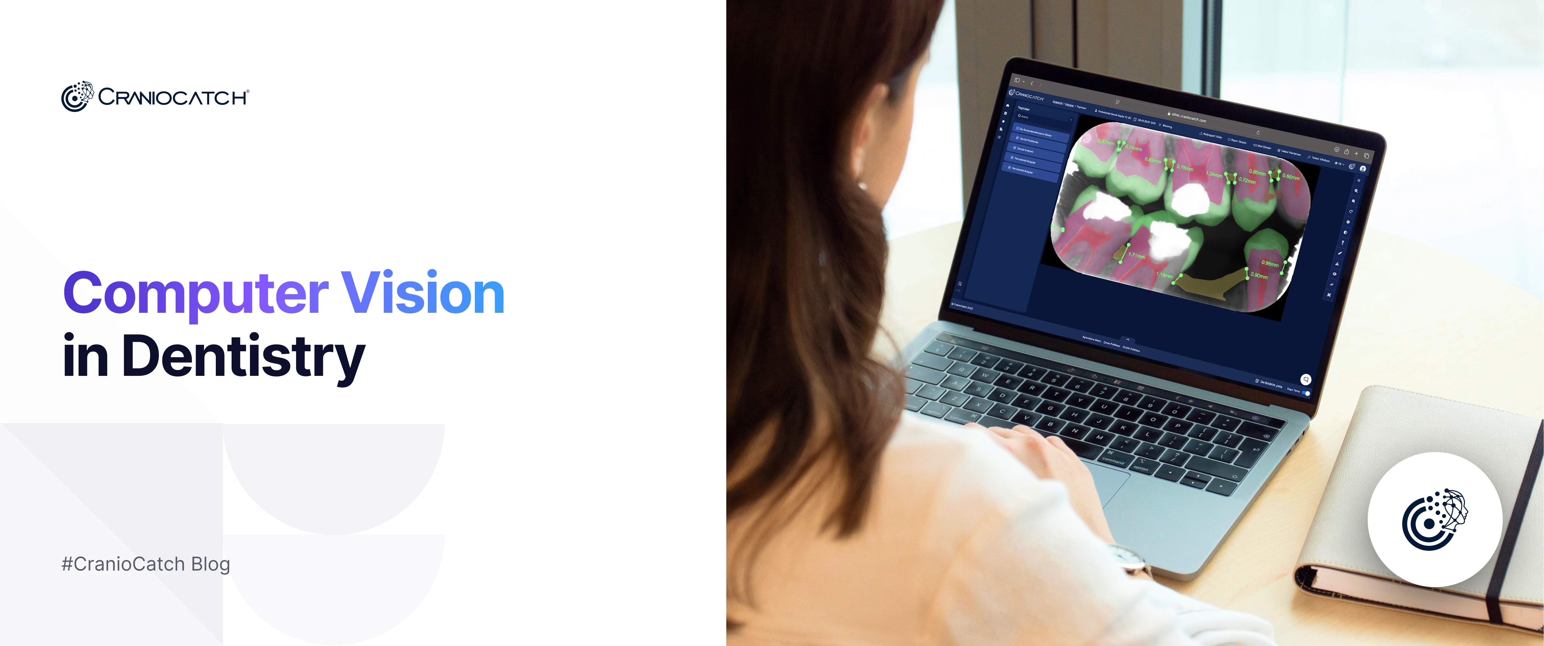 diş hekimi bilgisayardan diş röntgeni görüntülemesi yapıyor