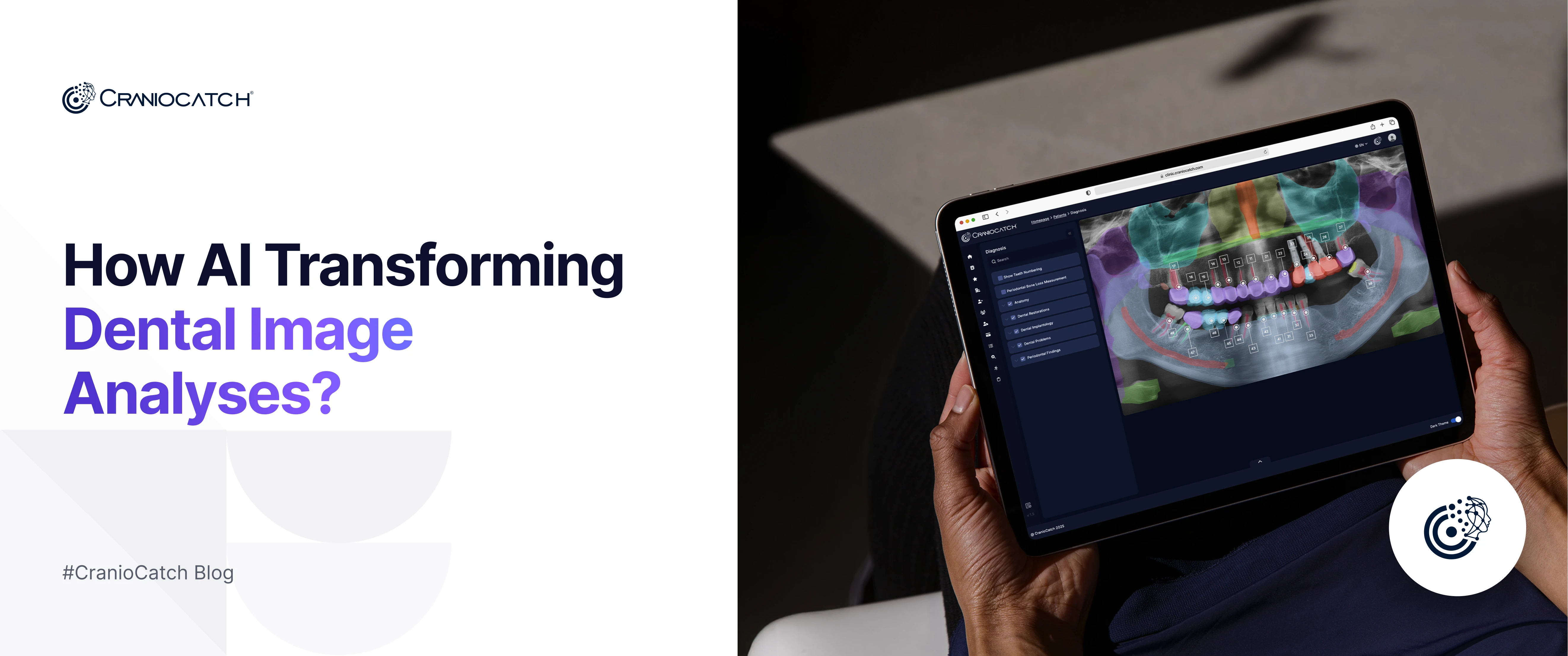 dental görüntüleme analizi