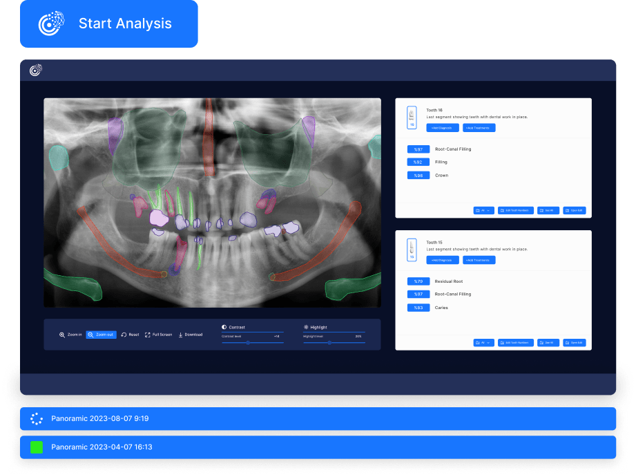 The patient's dental problems are determined by panoramic dental x-ray analysis