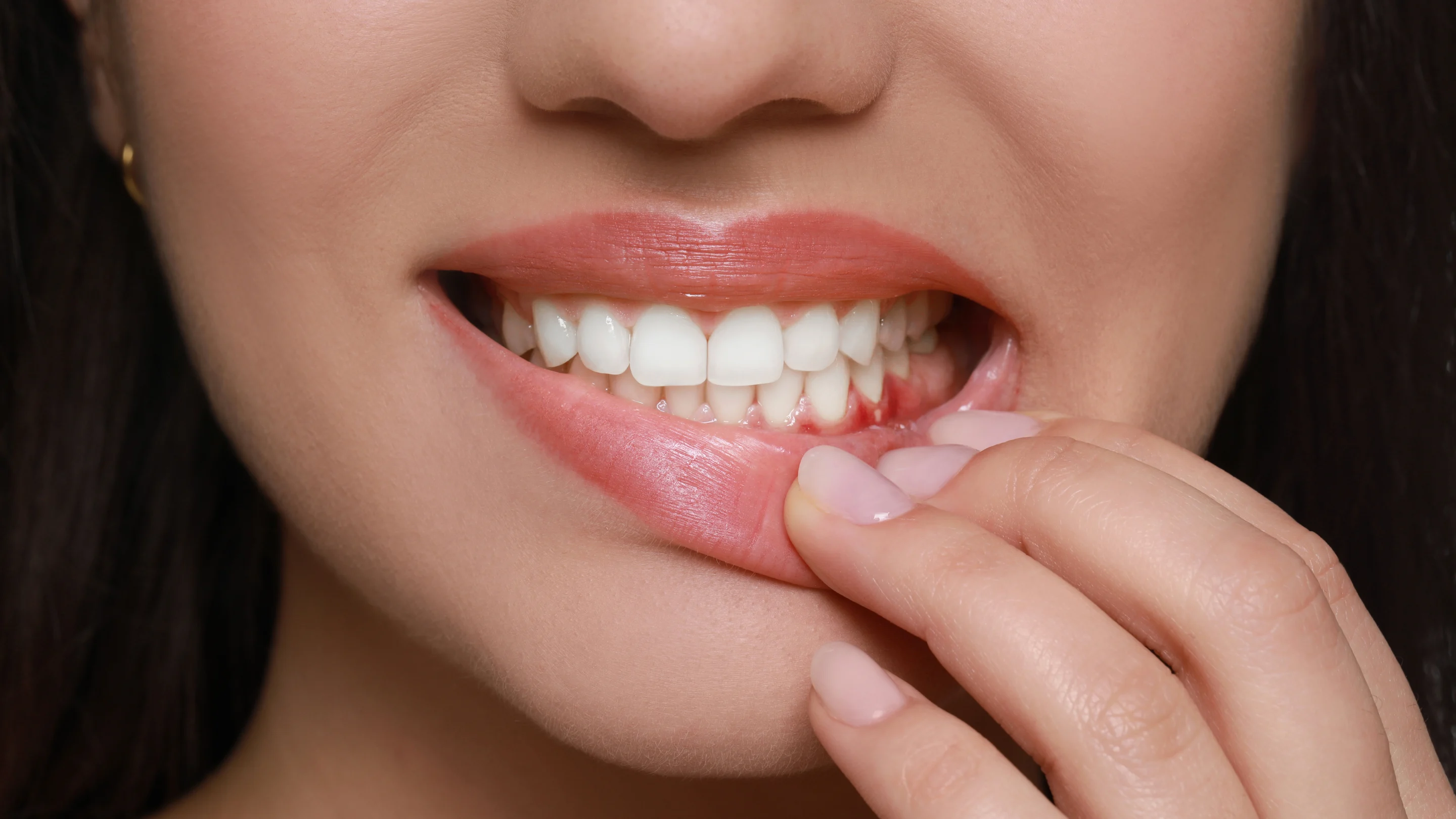 Receding gums result from factors like gum disease or poor oral hygiene