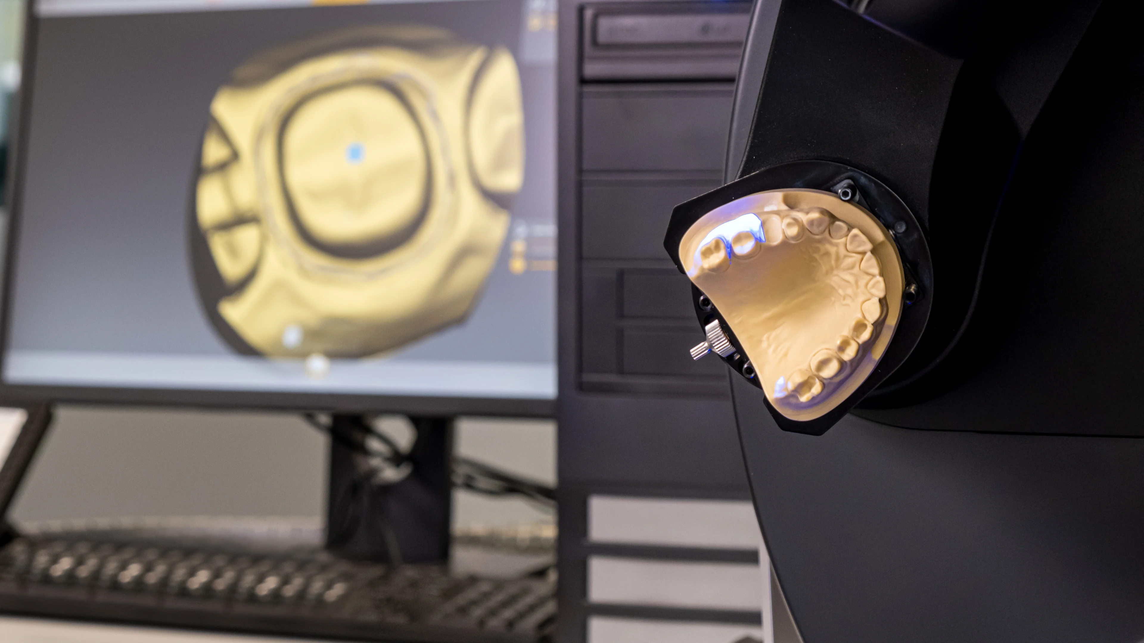 AI-supported dental crowns provide speeding up treatment processes