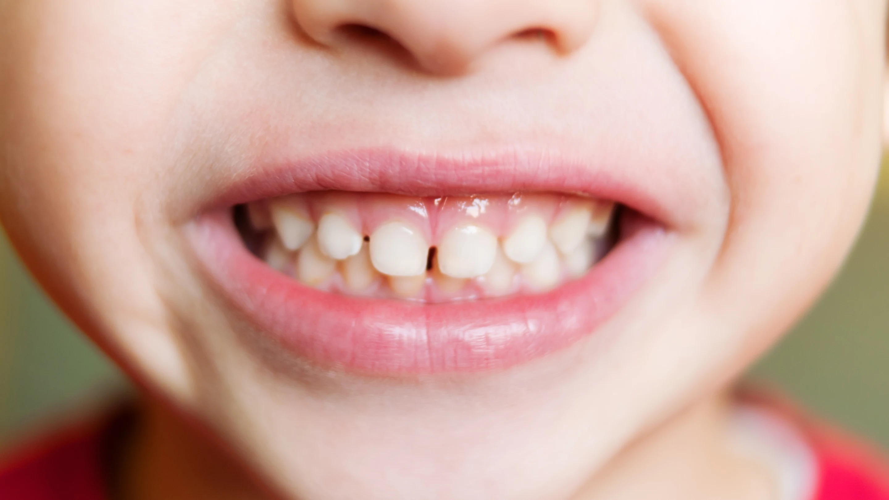 Number of teeth in children