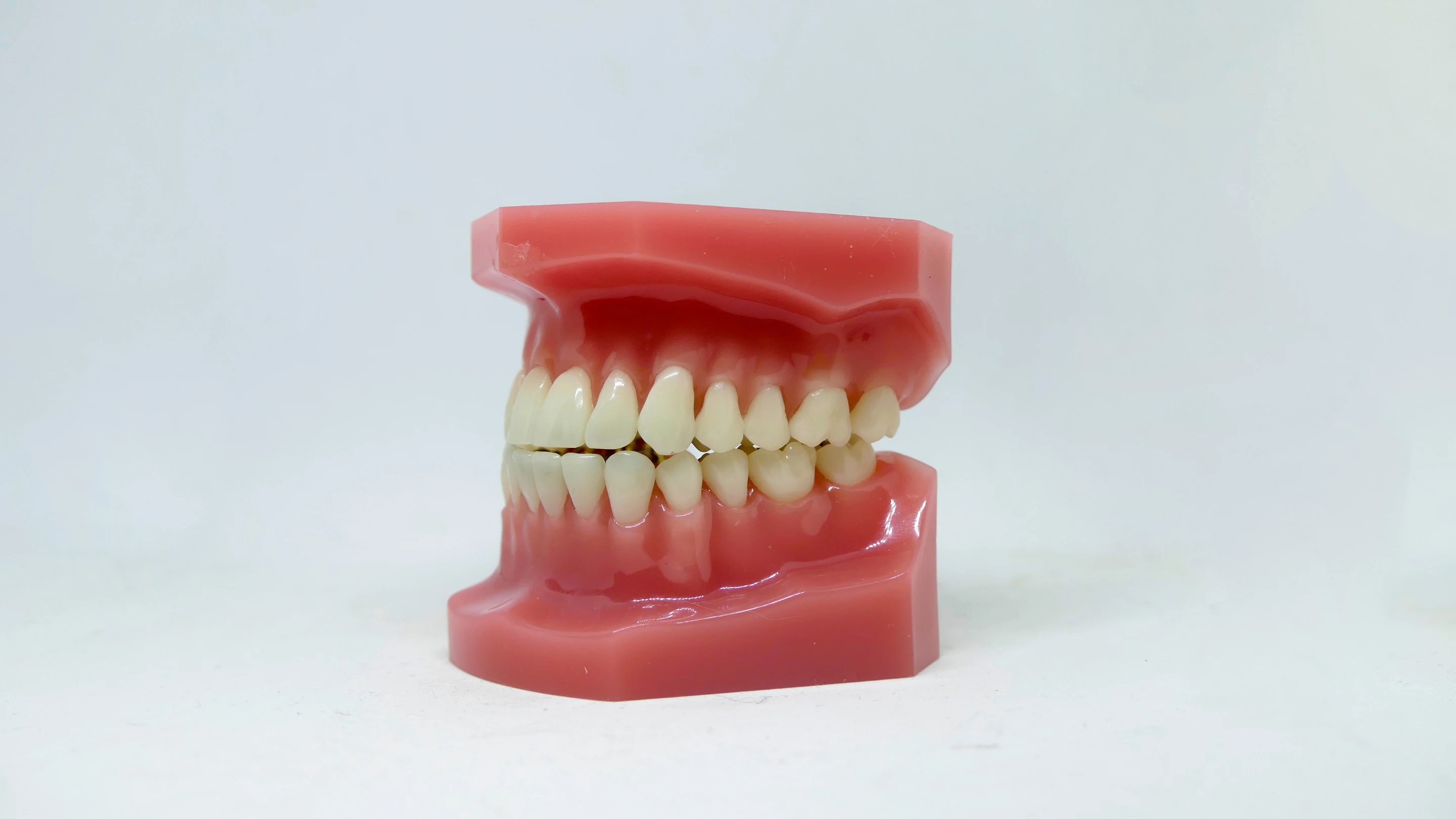 Teeth in the upper and lower jaws