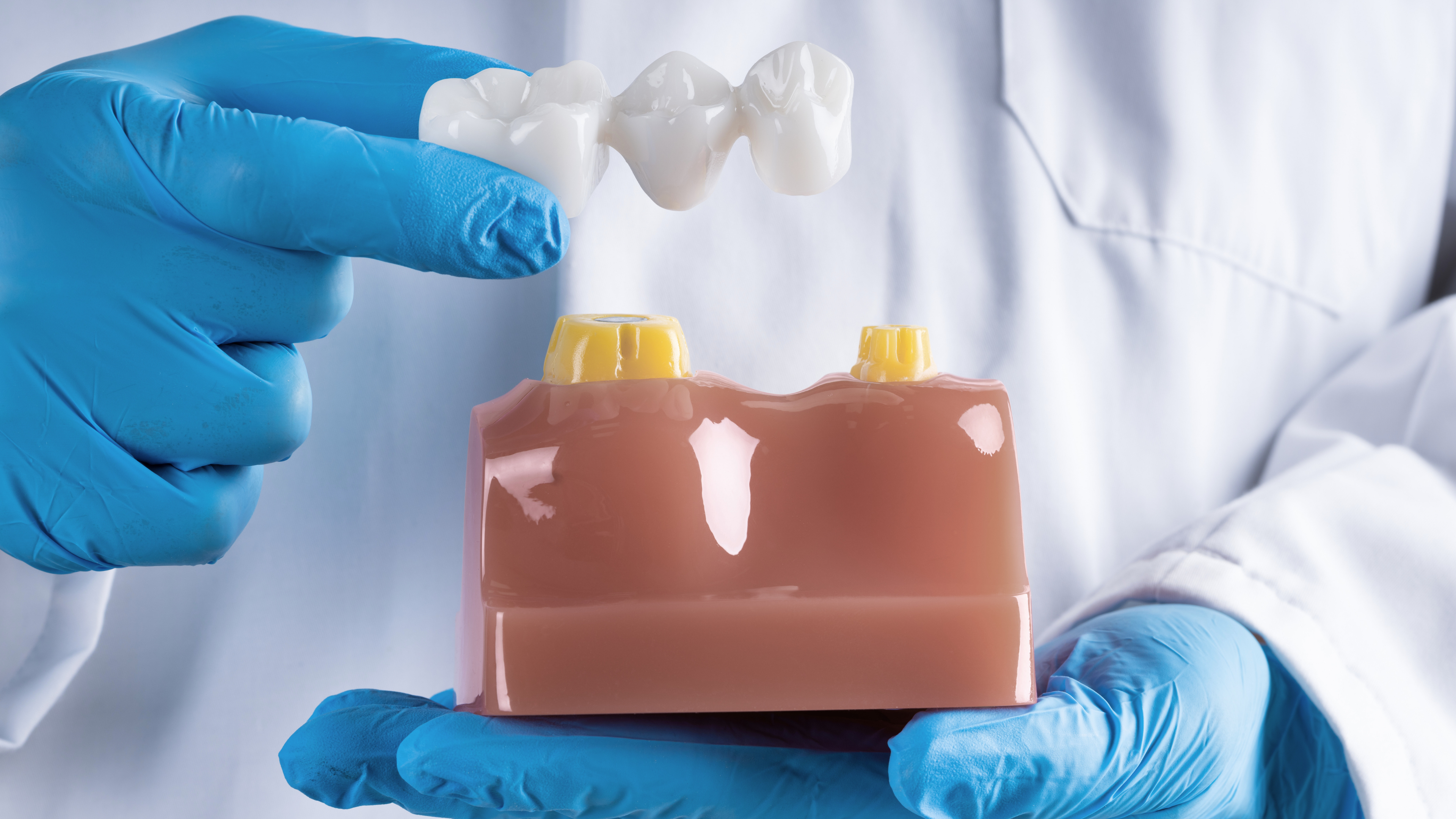 Gloved hands holding a dental bridge for one tooth above a gum model, demonstrating the process of bridging a tooth, such as a dental bridge front tooth or a front tooth bridge, commonly used in tooth bridges procedures.