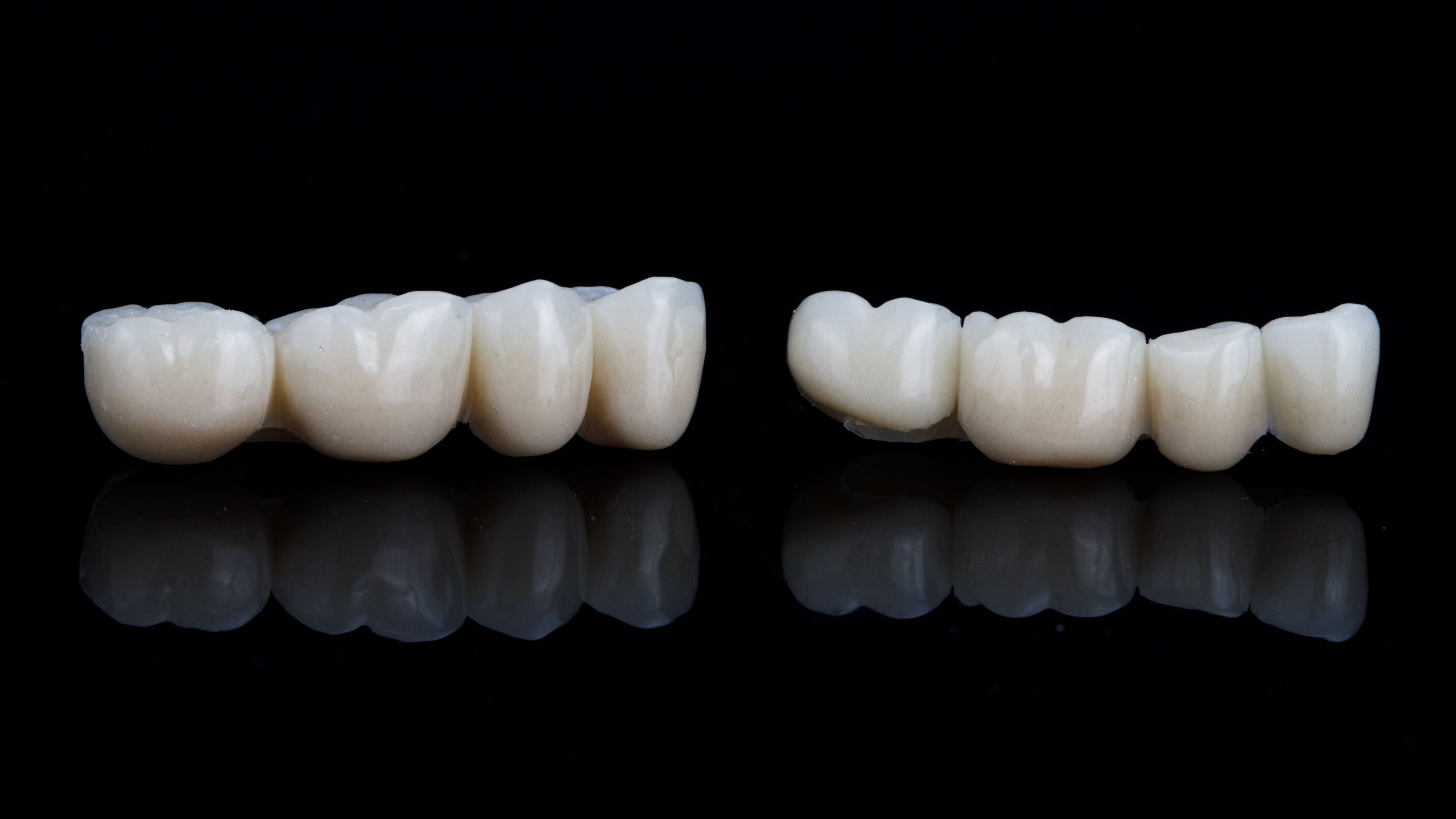 A close-up view of two dental bridges, showcasing a tooth bridge and a single tooth bridge on a reflective black surface, commonly used for bridging a tooth in dental procedures like a dental bridge for one tooth or a front tooth bridge.