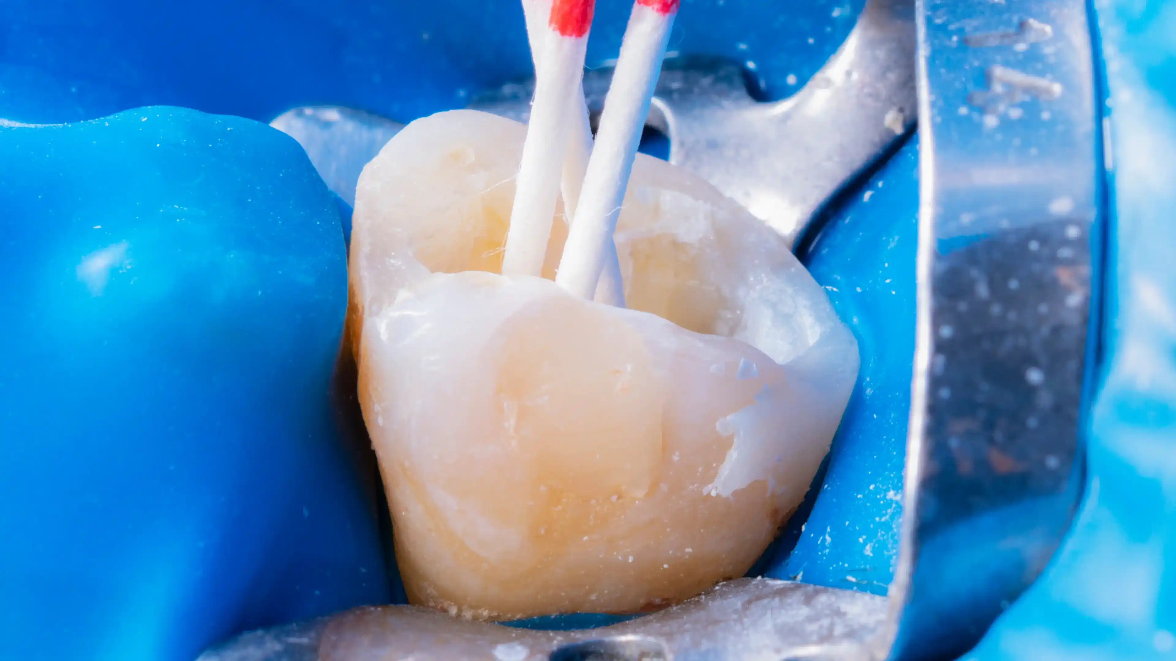 Natural remedy and dental care for infection