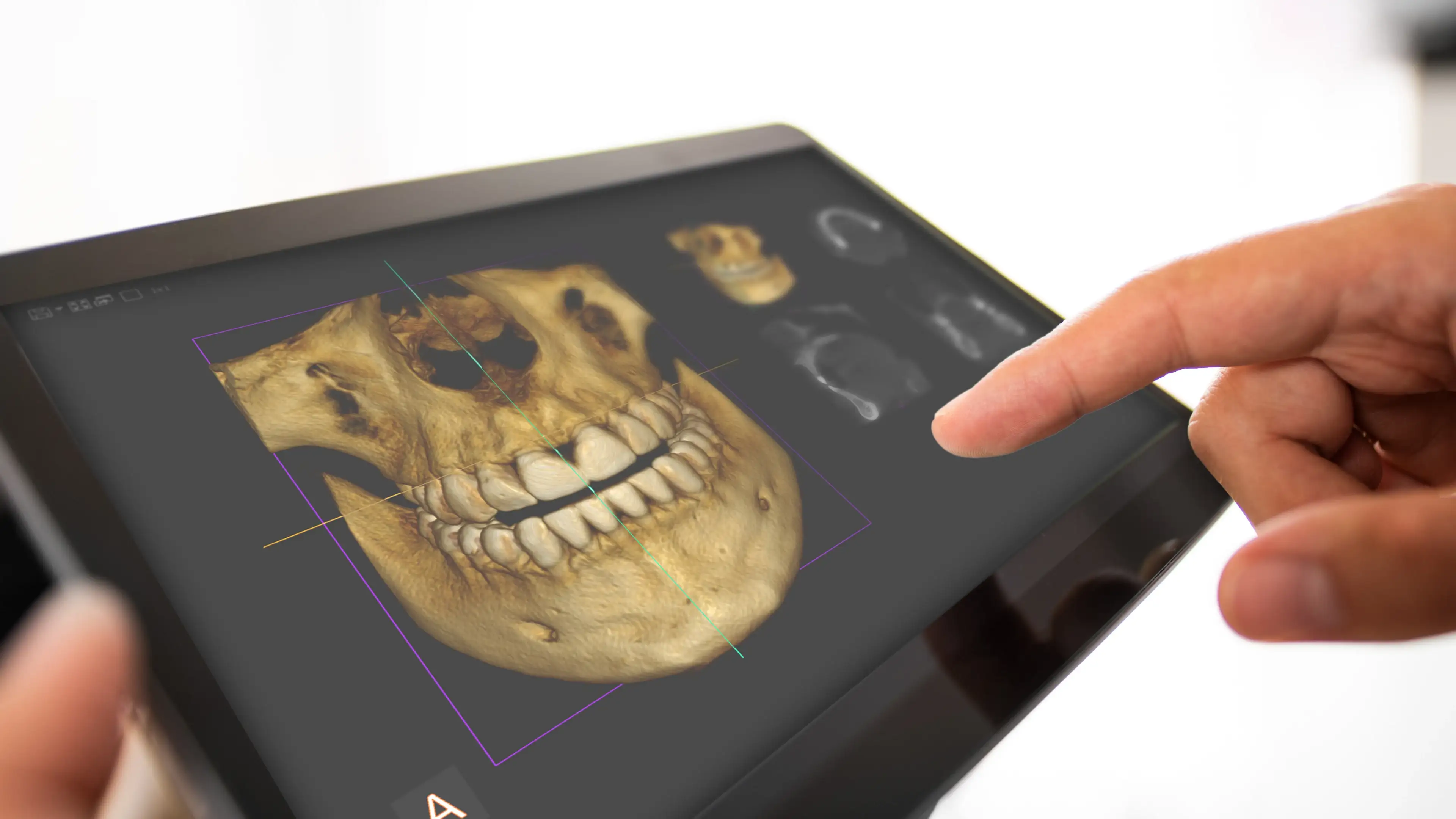 3D imaging software dental scan