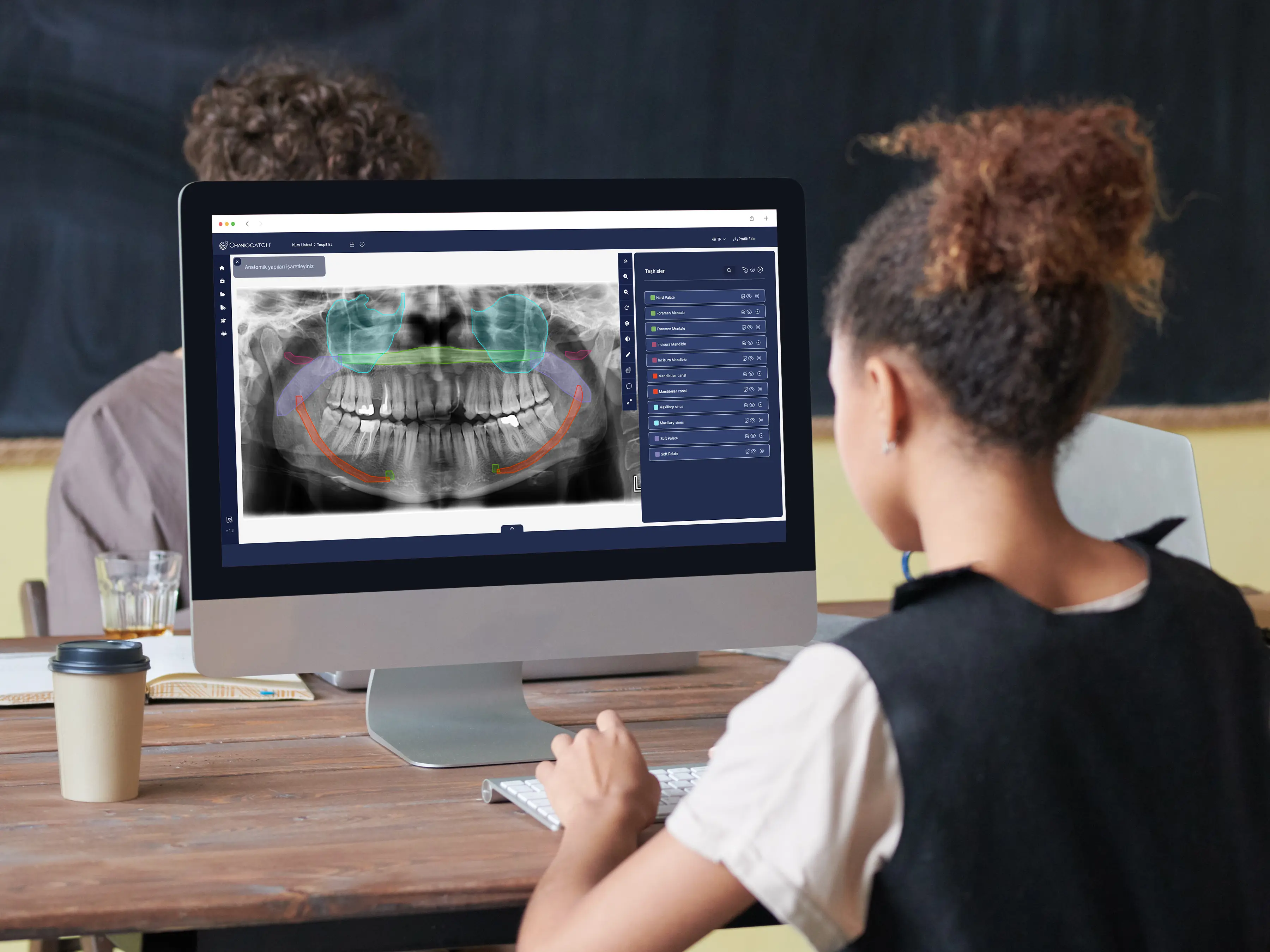 Female dentist reviewing panoramic dental X-rays with AI-detected anatomical landmarks on a laptop screen using CranioCatch.