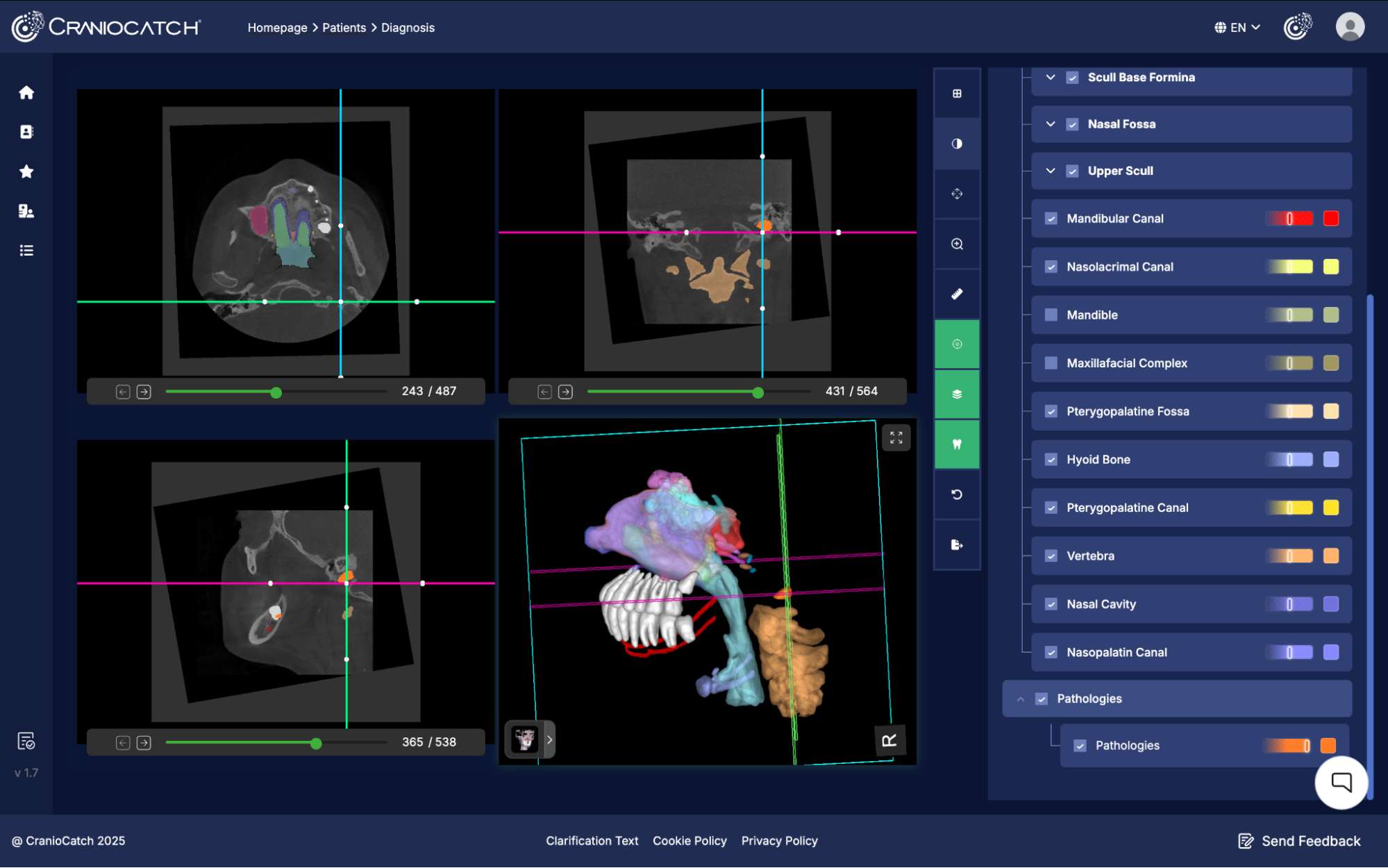 Geleneksel CBCT yorumlamaya kıyasla AI destekli analizlerin avantajlarını gösteren karşılaştırmalı tablo.