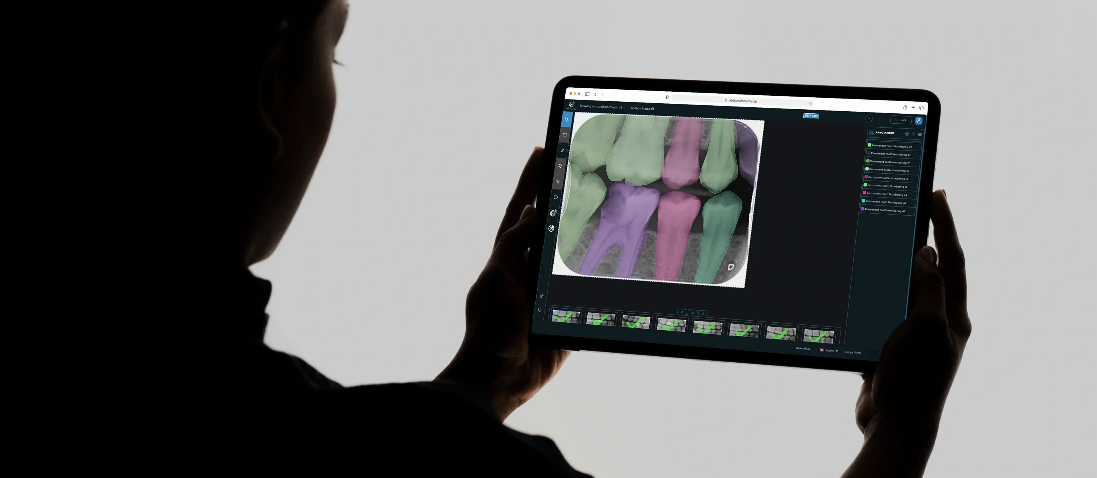 Tablette CranioCatch AILab ile bitewing radyografideki dişleri segmentleyip numaralandıran araştırmacı
