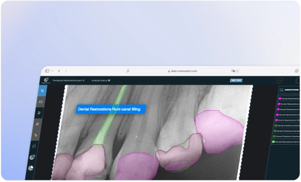 Radyografi üzerinde işaretlenmiş dental restorasyon etiketlerini içeren CranioCatch AILab etiket listesi