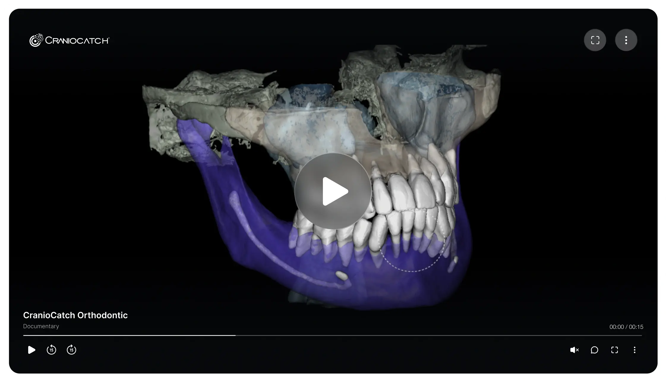 Alt çenenin vurgulandığı, üst ve alt çenenin 3B CBCT modelini gösteren video kapağı