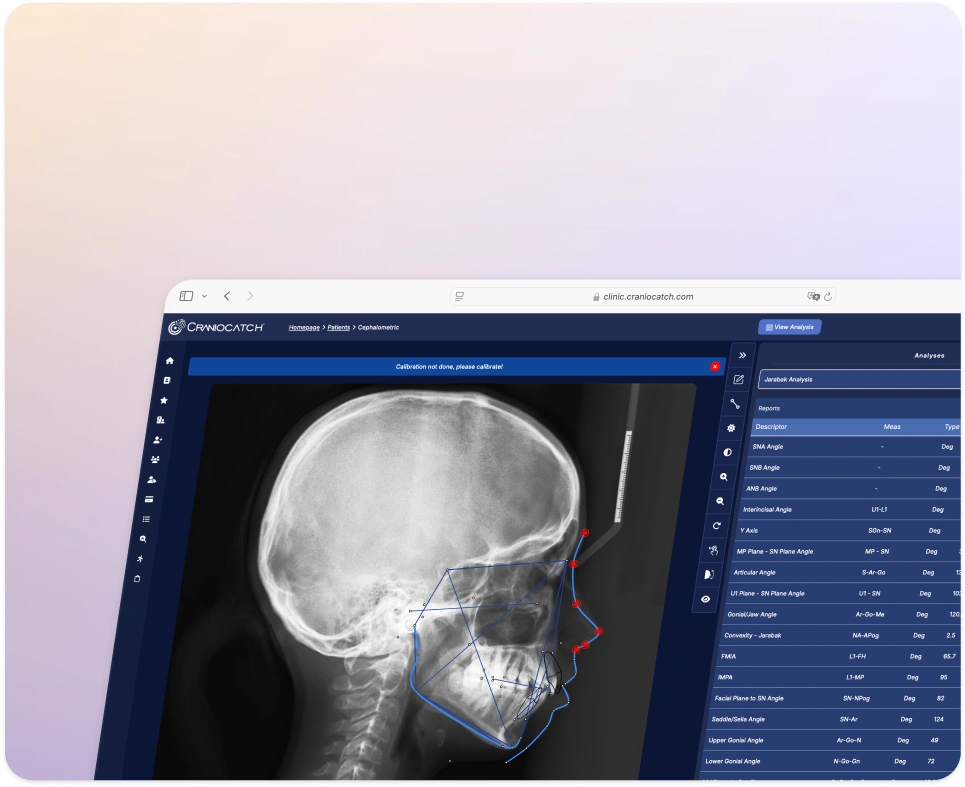 Lateral sefalometrik radyografide noktaları çizilmiş Jarabak analizini gösteren CranioCatch Angle
