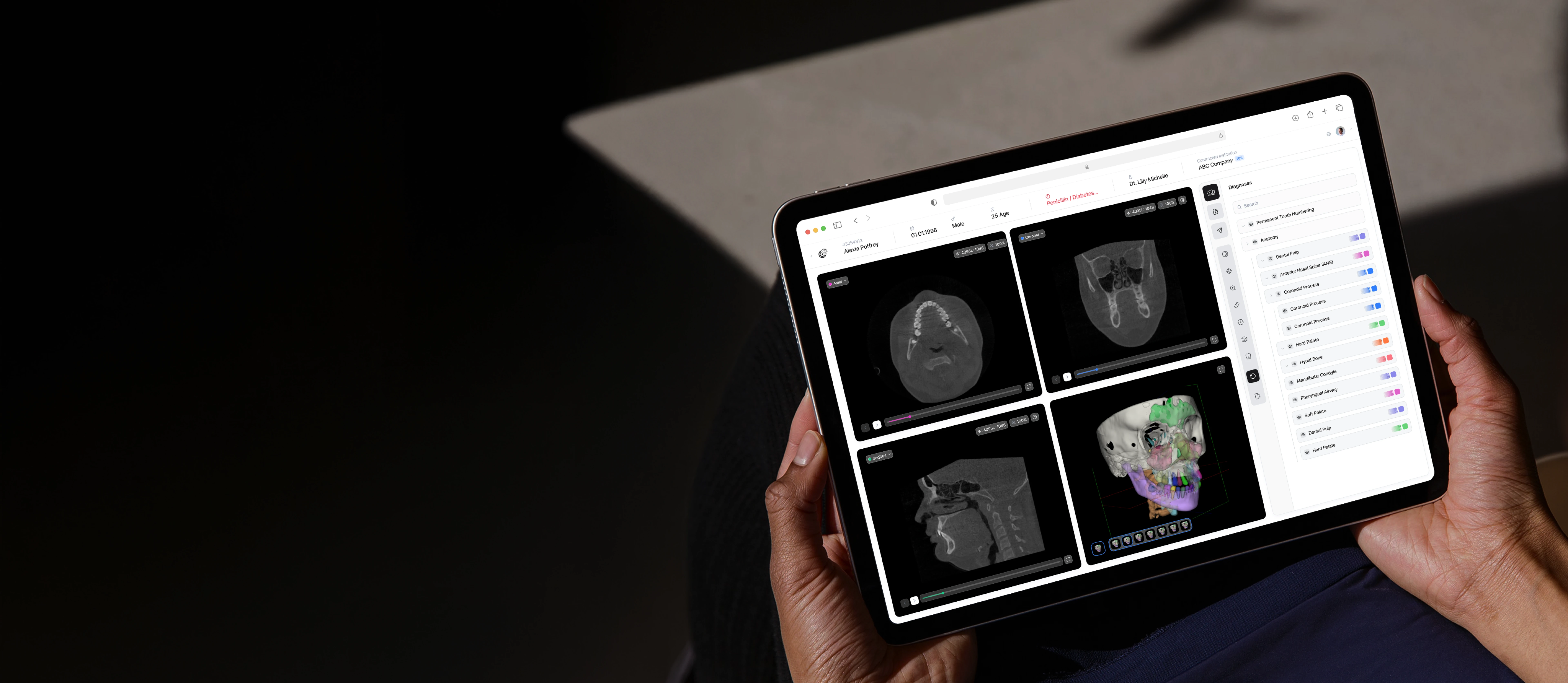 CranioCatch Clinic showing axial, coronal, sagittal and 3D CBCT views of a jaw on a tablet