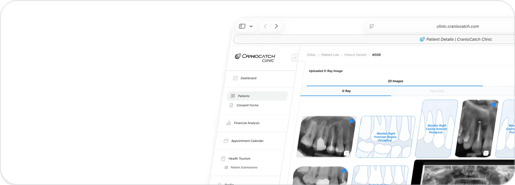Yüklenen 2B röntgen görüntülerini diş bölgesine göre listeleyen CranioCatch Clinic hasta detay ekranı