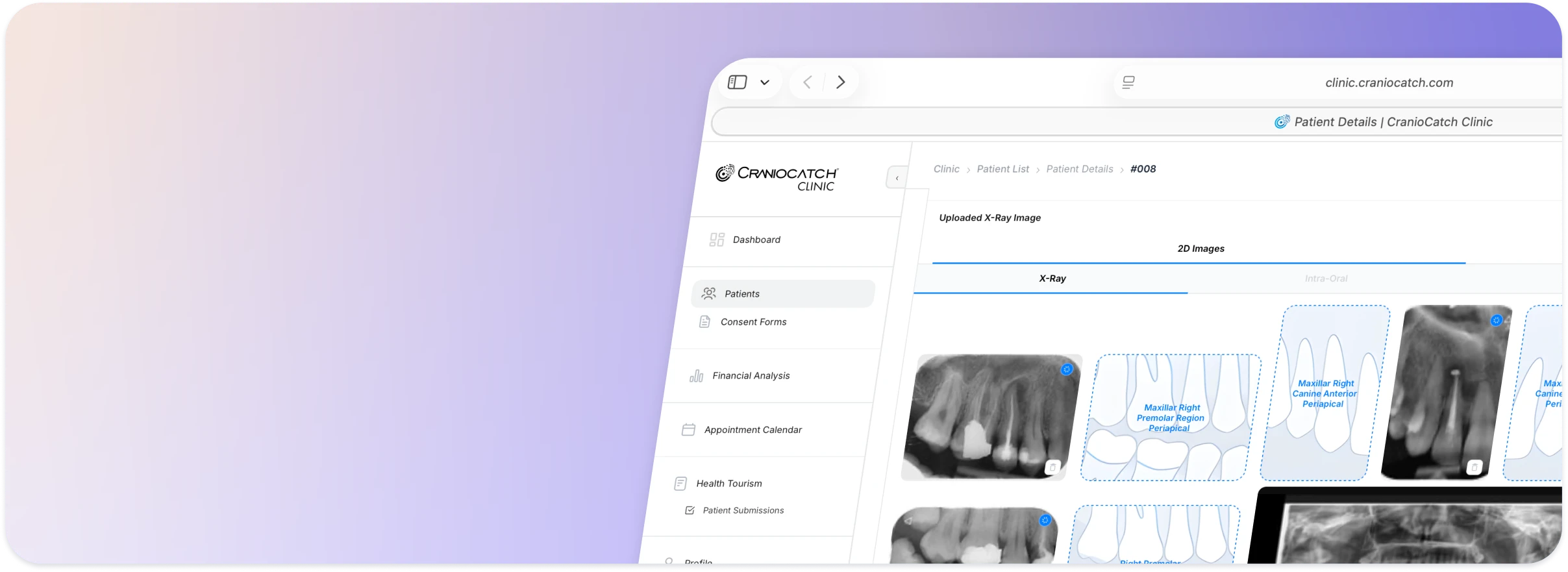 CranioCatch Clinic patient detail screen listing uploaded 2D X-ray images by tooth region