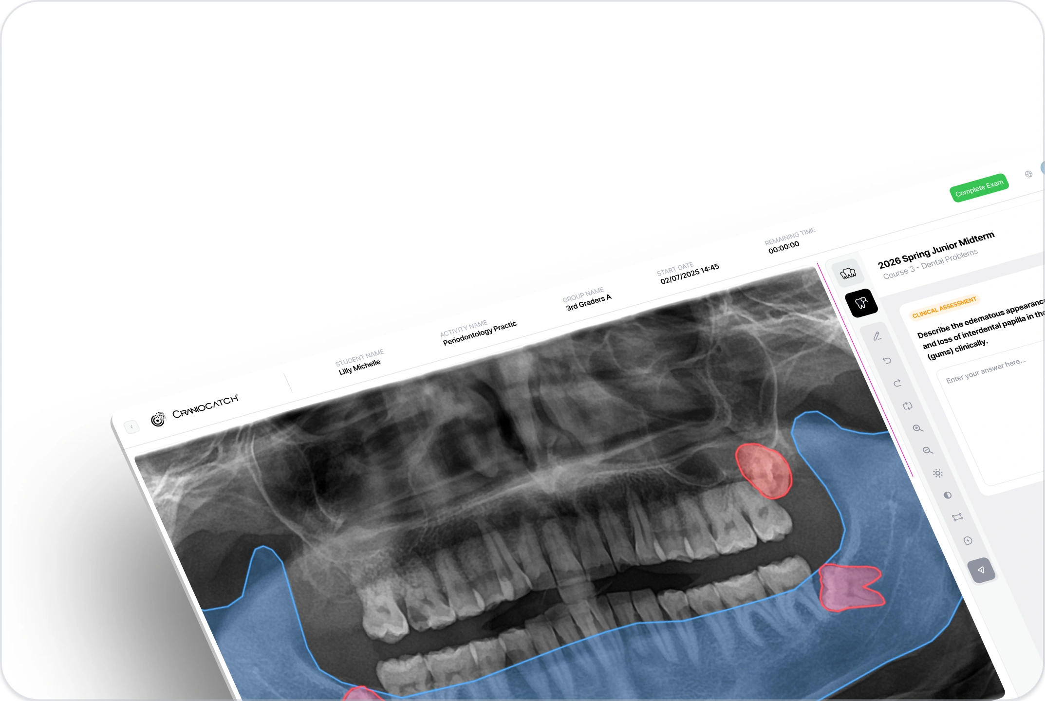 Öğrenciden panoramik radyografide maksiller sinüsleri ve mandibular kanalları işaretlemesini isteyen CranioCatch Edu pratik ekranı