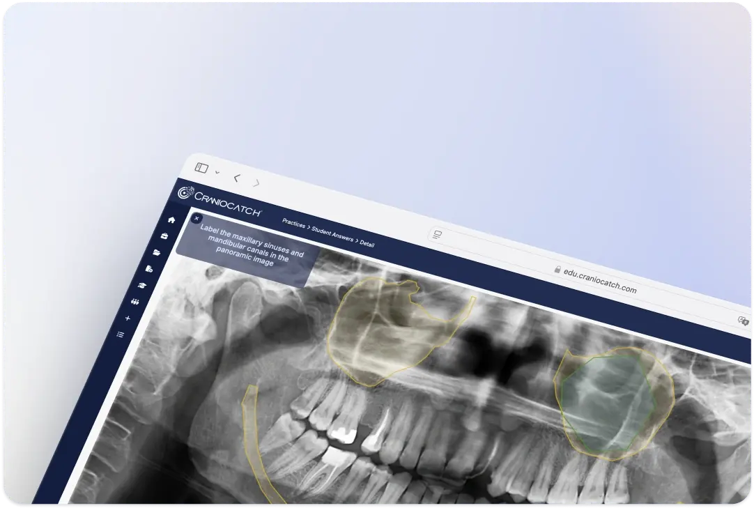 Öğrenciden panoramik radyografide maksiller sinüsleri ve mandibular kanalları işaretlemesini isteyen CranioCatch Edu pratik ekranı