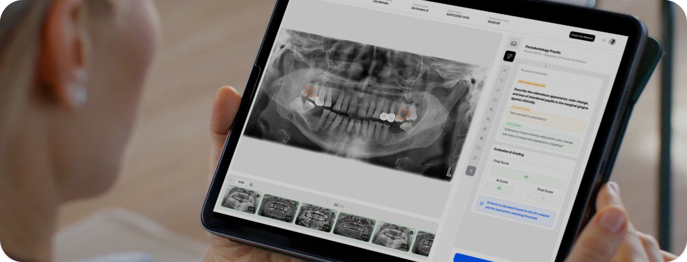 Tablette CranioCatch Edu üzerindeki kişiselleştirilmiş panoramik radyografi alıştırmasını inceleyen öğrenci
