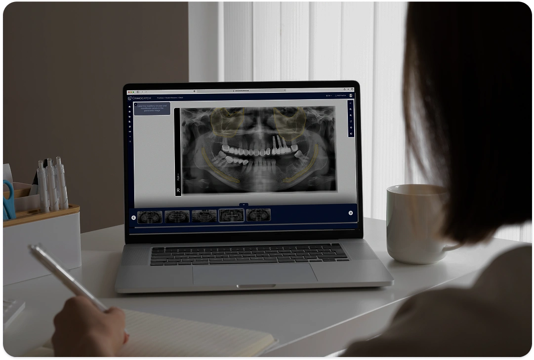 CranioCatch Edu üzerinde panoramik radyografi vakası çözerken not alan öğrenci