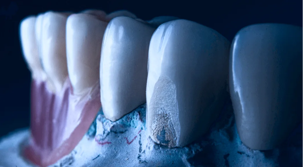 Visualizing the treatment