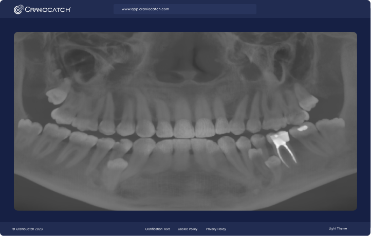 CBCT Görüntüsü