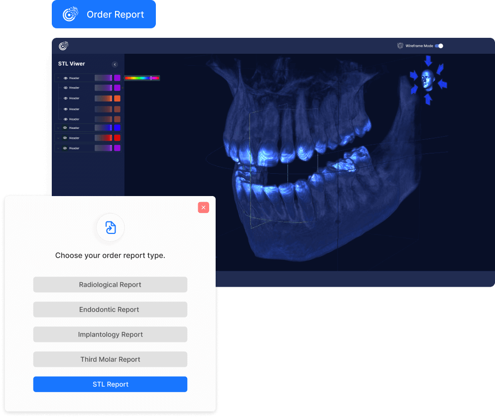 3D STL VIEWER